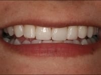 Konig Center for Cosmetic & Comprehensive Dentistry smile photos